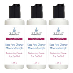 Wholesale Maximum Strength Deep Acne Cleanser & Pigment Removal Wash 300 of the 5oz