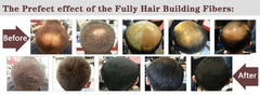 White Label Hydrolyzed Keratin Fibrils 99.9% & 0.1% Crystalline Minoxidil Sulfate 50g and Fiber Holding Spray 120ml