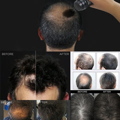 White Label Hydrolyzed Keratin Fibrils 99.9% & 0.1% Crystalline Minoxidil Sulfate 50g and Fiber Holding Spray 120ml