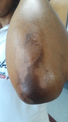 Private Label Best Skin Bleach Regimen For Hands, Feet Treatment, Knuckles, Elbows and Heels